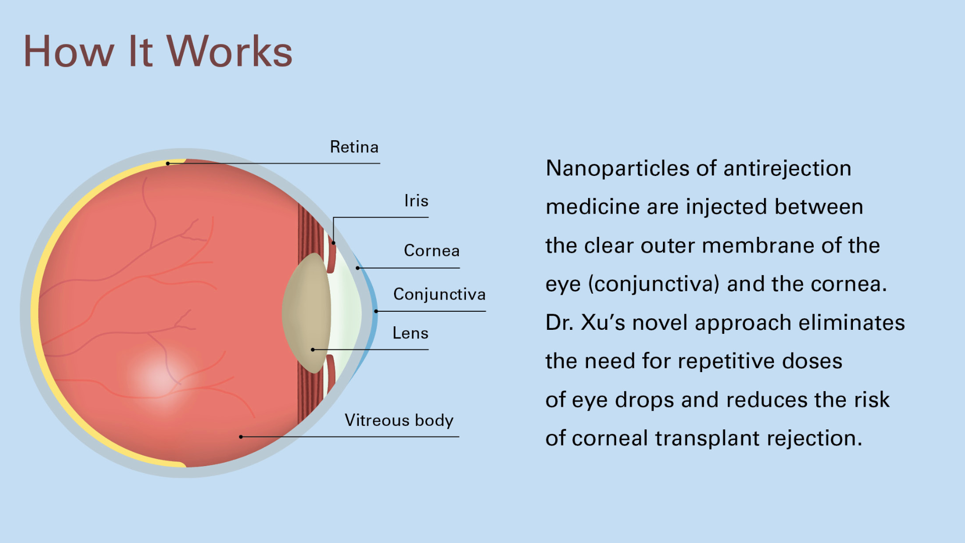 An infographic with an illustration of the eye's anatomy. The infographic has the text: 